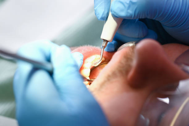 Best Emergency Tooth Extraction in Rupert, WV