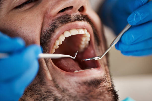 Best Emergency Tooth Extraction in Rupert, WV